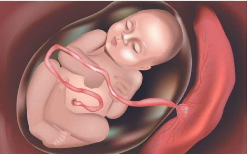 Ca nhau cài răng lược hiếm gặp ở sản phụ chưa từng mổ lấy thai- Ảnh 3.
