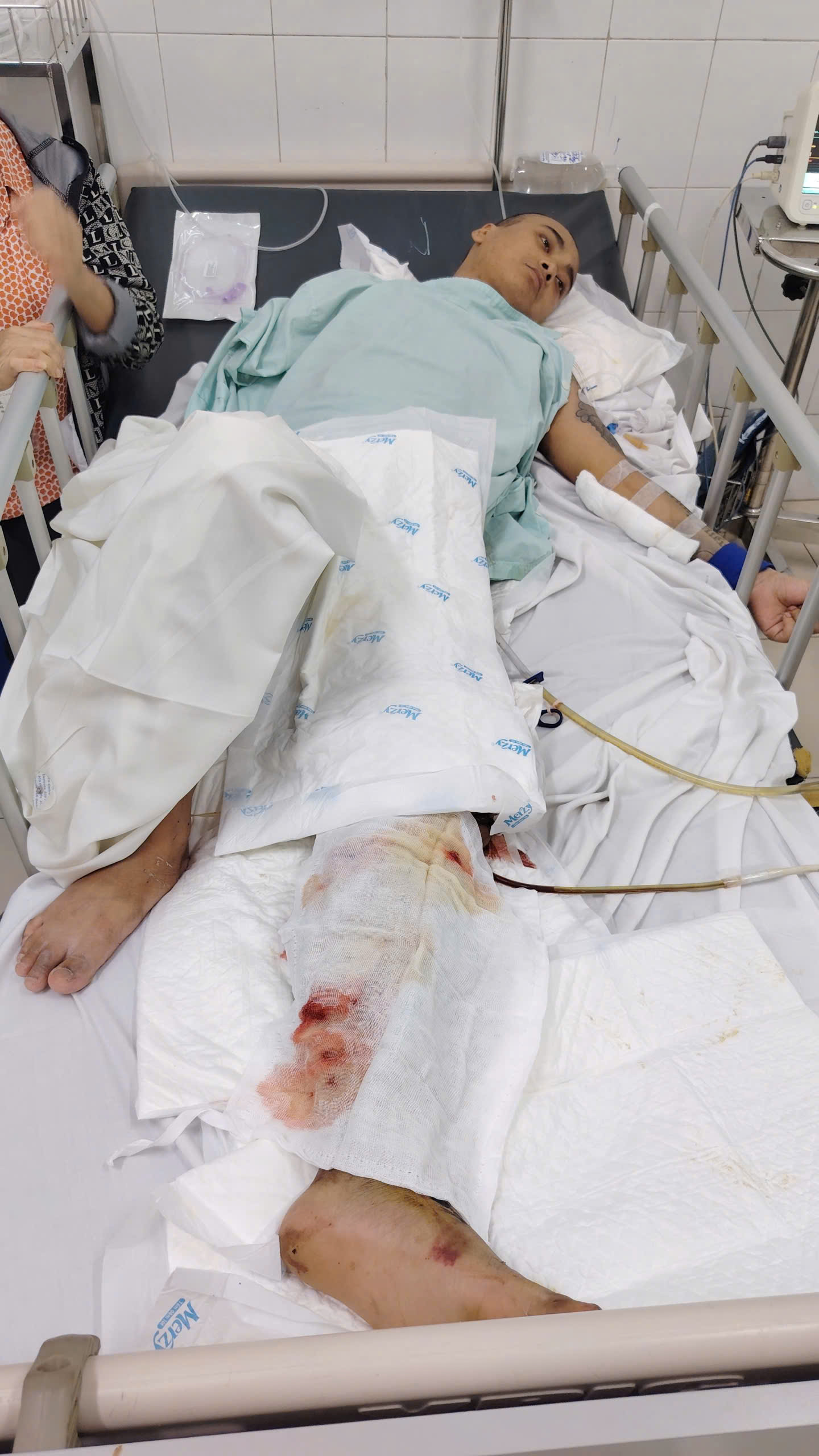 Trên đường thăm hai con nhỏ, người cha trẻ gặp nạn nguy kịch, mẹ già bất lực trước chi phí điều trị- Ảnh 1.