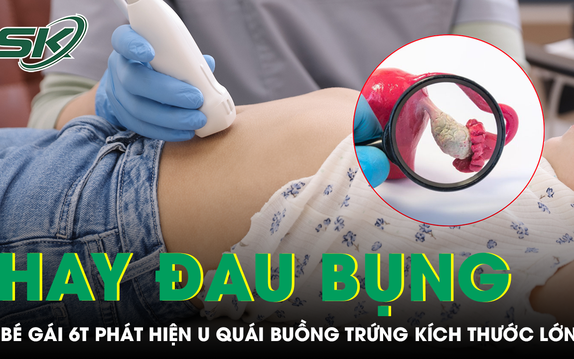 Bé sơ sinh 2 ngày tuổi mang khối u quái nặng 1,1kg- Ảnh 3. Bé sơ sinh 2 ngày tuổi mang khối u quái nặng 1,1kg- Ảnh 3.