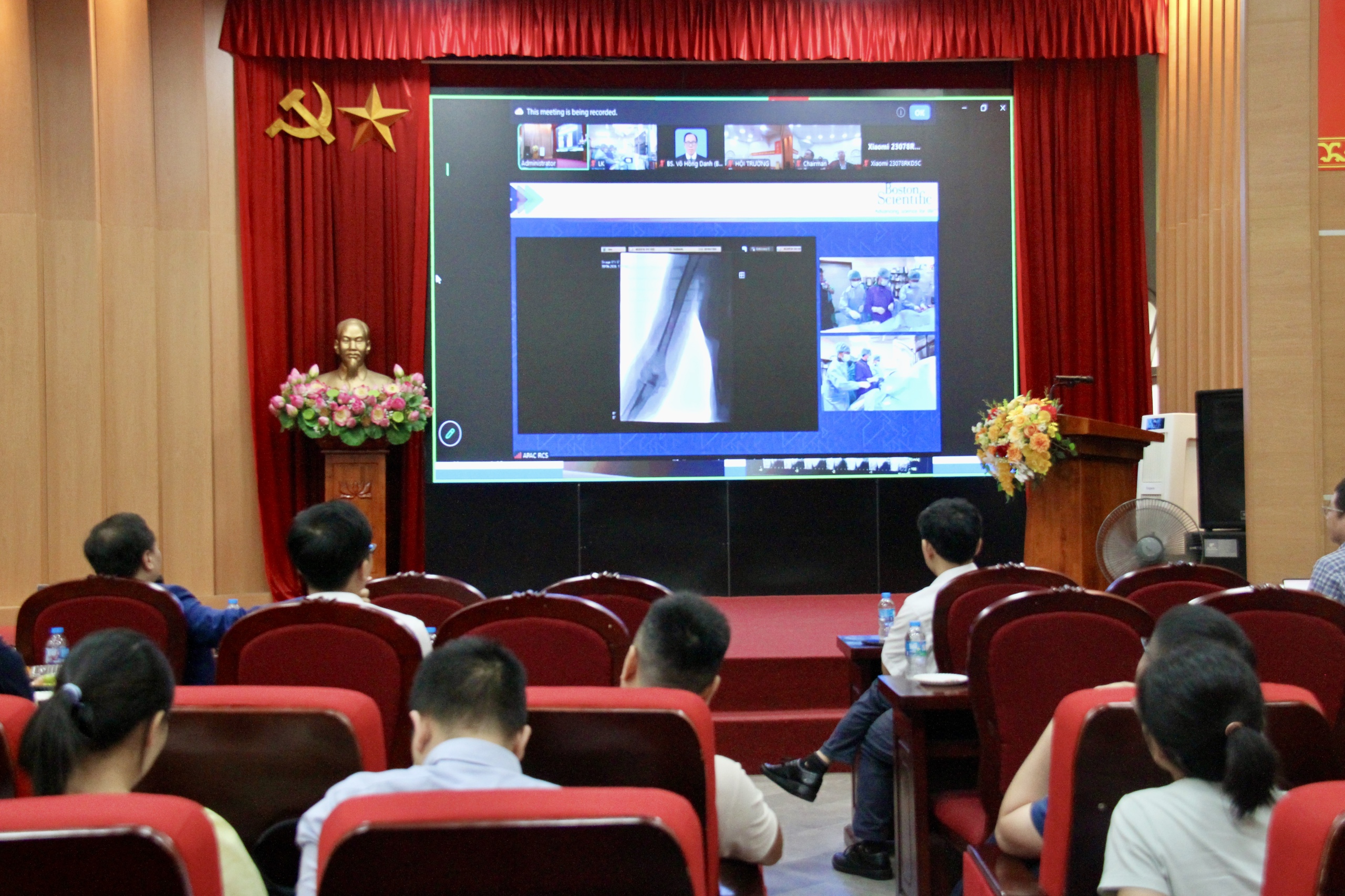 Bệnh động mạch ngoại biên gia tăng, ai cần chủ động tầm soát? - Ảnh 2.