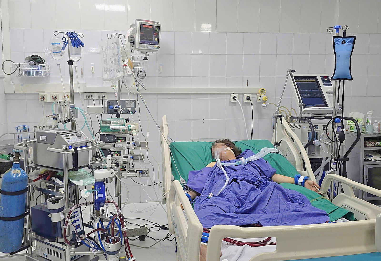 Cứu sống người phụ nữ sốc nhiễm khuẩn, suy đa tạng do bệnh Whitmore- Ảnh 1. Cứu sống người phụ nữ sốc nhiễm khuẩn, suy đa tạng do bệnh Whitmore- Ảnh 1.
