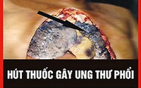 Tuyến y tế cơ sở - 'cánh tay nối dài' trong hỗ trợ cai nghiện thuốc lá- Ảnh 3. WHO: Cảnh báo trên bao bì thuốc lá là cách truyền thông hiệu quả, ít tốn kém