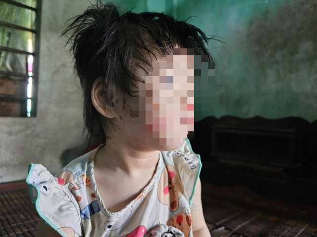 Sở Y tế Quảng Trị lên tiếng vụ cháu bé bị mẹ và cậu tâm thần gây hại- Ảnh 2. Sở Y tế Quảng Trị lên tiếng vụ cháu bé bị mẹ và cậu tâm thần gây hại- Ảnh 2.