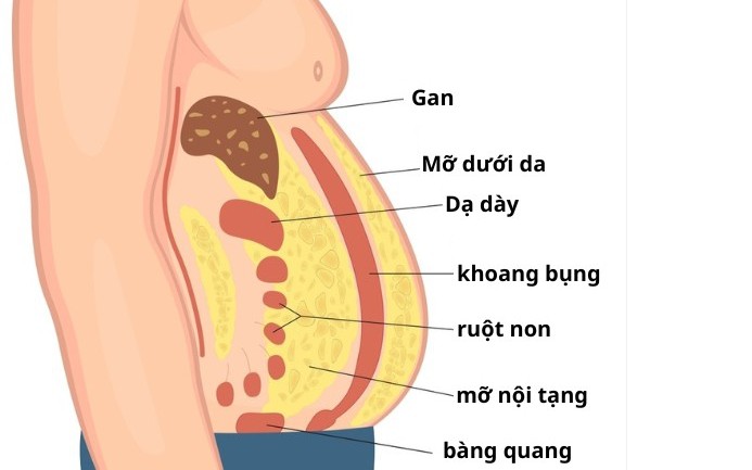 7 nguyên tắc giúp giảm và kiểm soát mỡ nội tạng, bảo vệ hệ tim mạch, chuyển hóa - Ảnh 2.