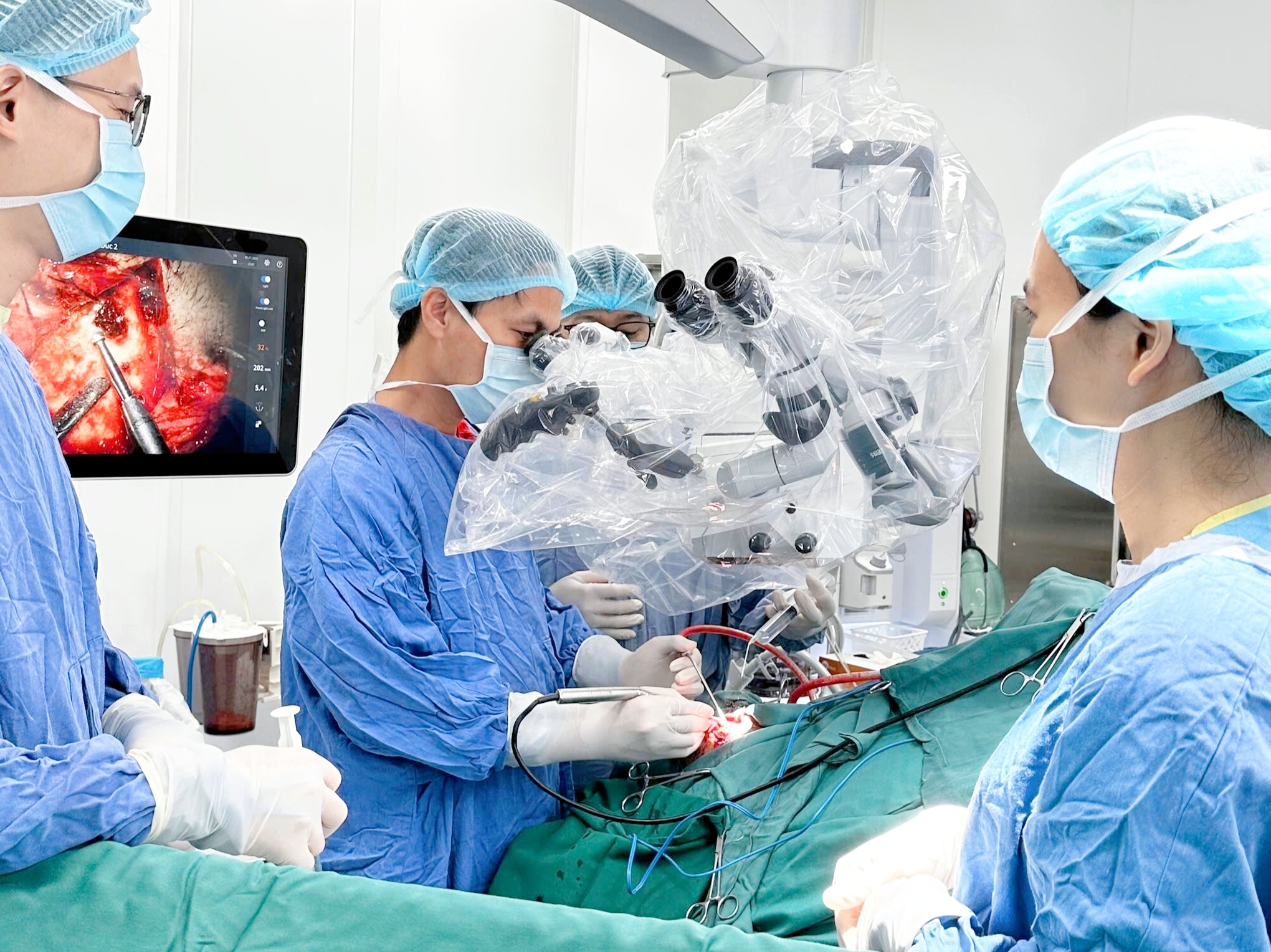 Ca phẫu thuật trong đêm đầu tiên cứu bệnh nhân nặng tại Bệnh viện Hữu nghị Việt Đức cơ sở Ninh Bình- Ảnh 2.