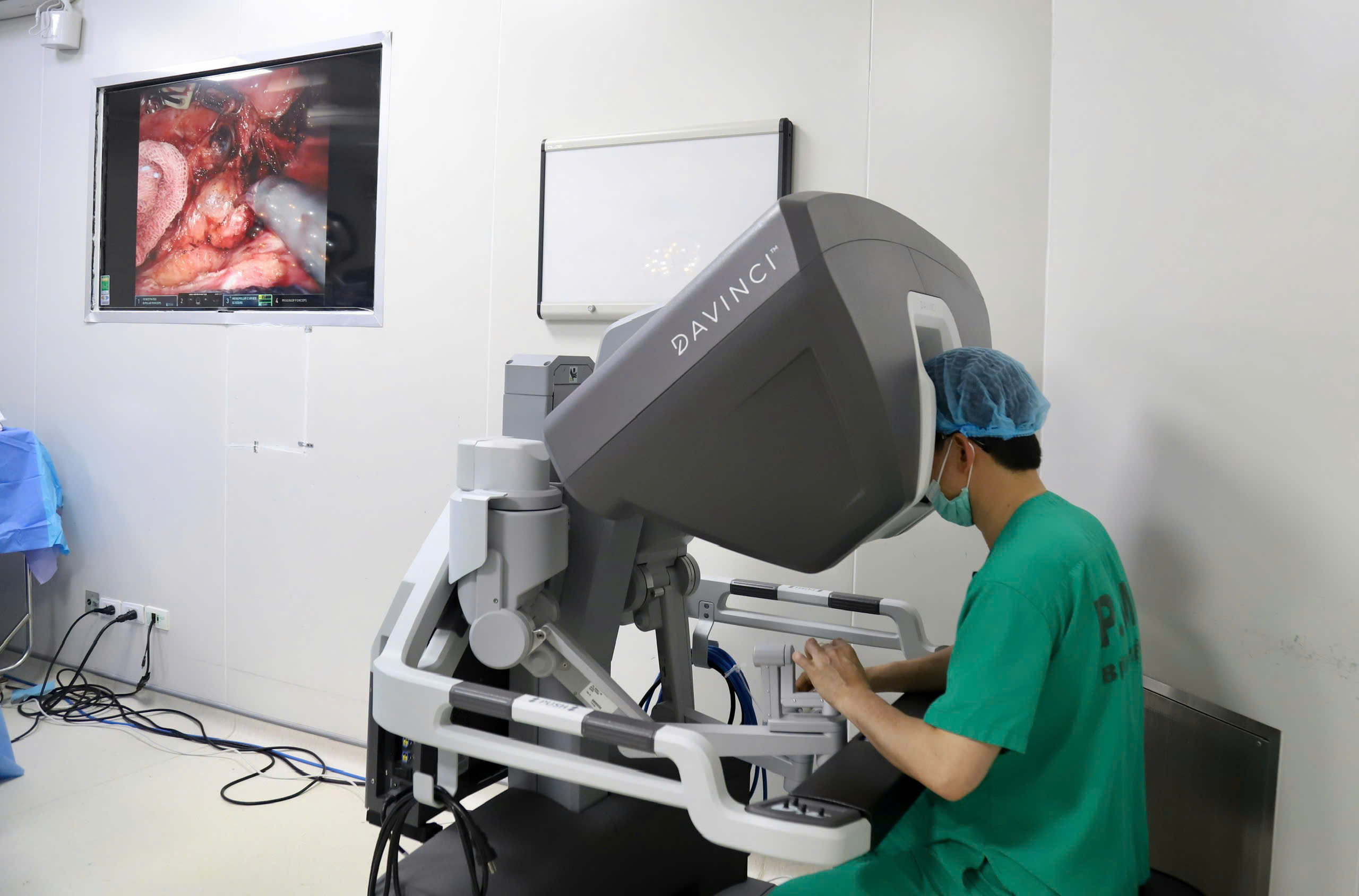 Gallery - Đào tạo phẫu thuật nội soi robot tại Việt Nam nâng cao điều trị ung thư hiện đại - image 3