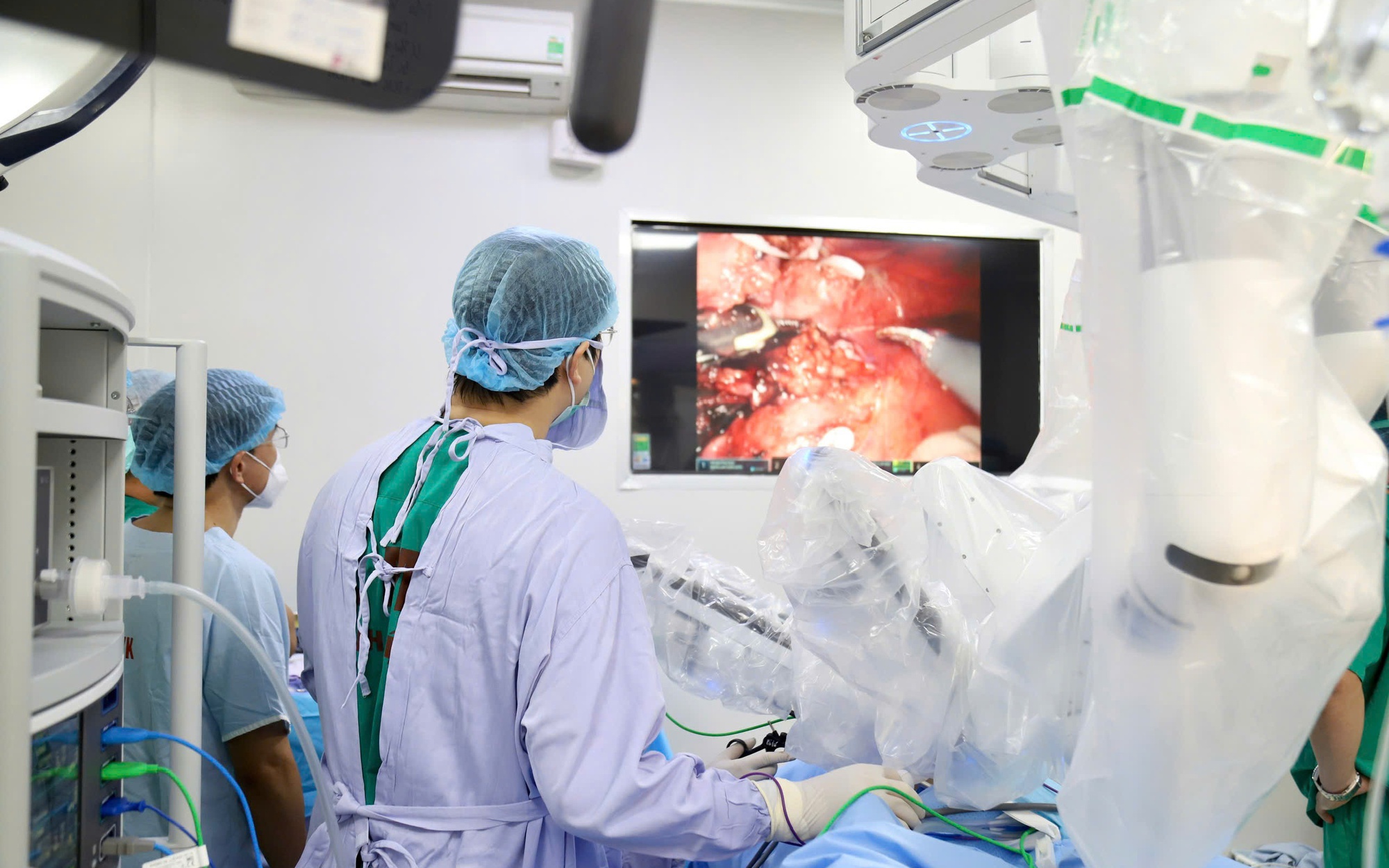 Kỷ nguyên mới của ngoại khoa ung thư: Đẩy mạnh ứng dụng robot trong phẫu thuật chuỗi ca bệnh khó- Ảnh 7.