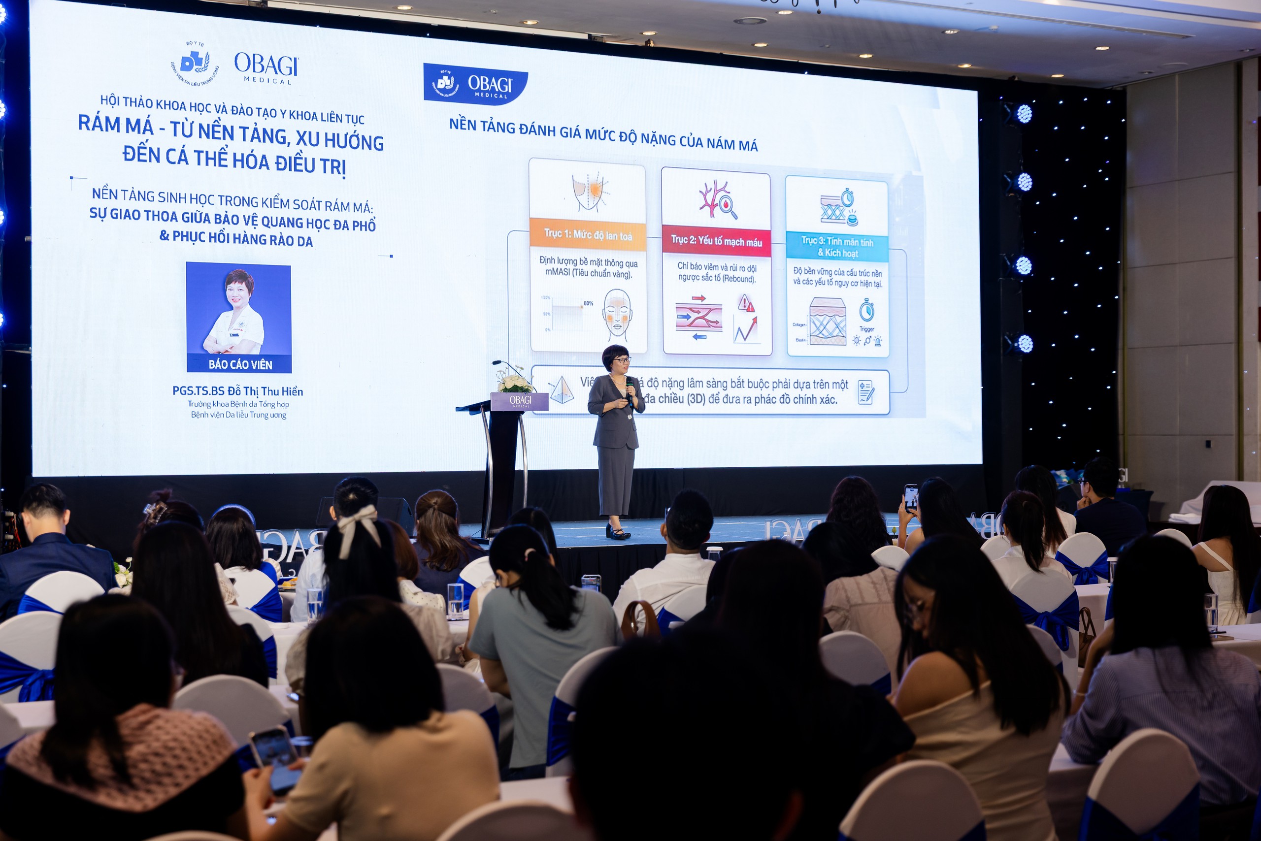 Rám má không còn là bệnh lý thẩm mỹ đơn thuần - Ảnh 2.