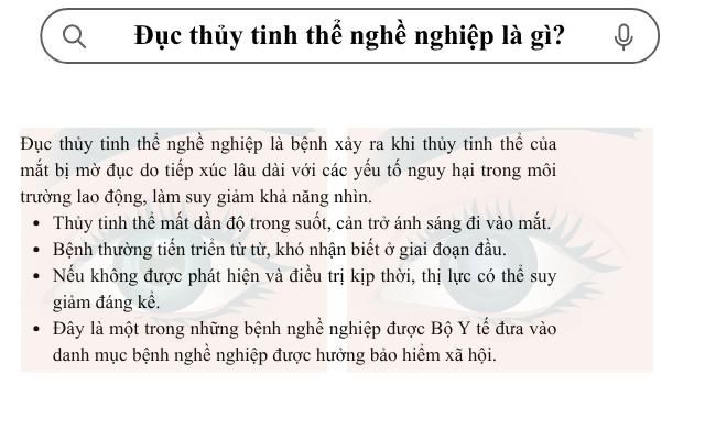 Nhận diện nguy cơ mắc bệnh đục thủy tinh thể nghề nghiệp - Ảnh 1.