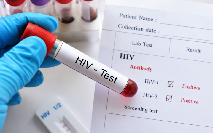 HIV có chữa khỏi hoàn toàn được không? - Ảnh 3.