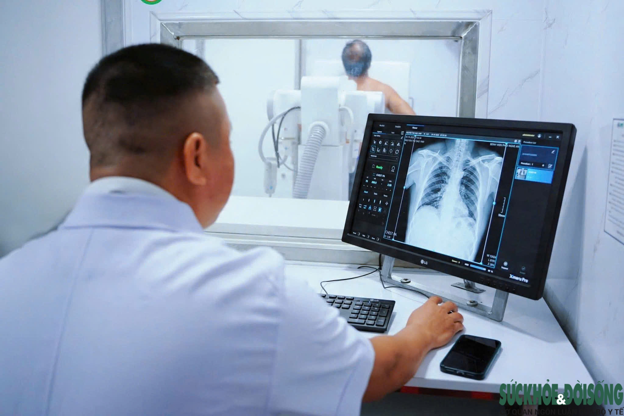 Nguyên nhân nhiều người không hút thuốc vẫn mắc ung thư phổi- Ảnh 3.