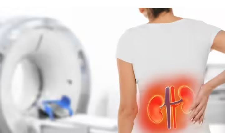 Dinh dưỡng đúng cách giúp bảo vệ thận từ sớm - Ảnh 2.