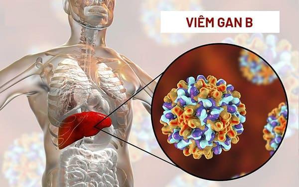 Mẹ bị viêm gan B có thể nuôi con bằng sữa mẹ không?- Ảnh 2.