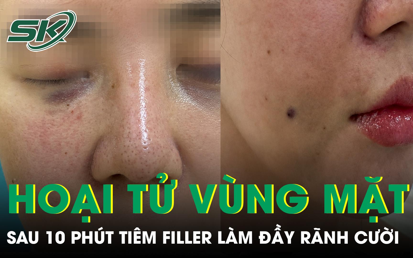 - Ảnh 3.