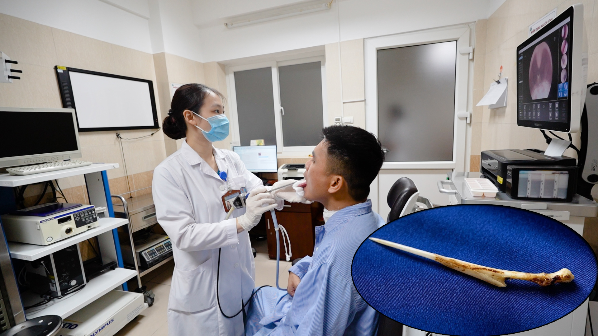 Gallery - Cố nuốt miếng cơm to để chữa hóc xương, người đàn ông thủng thực quản - image 1