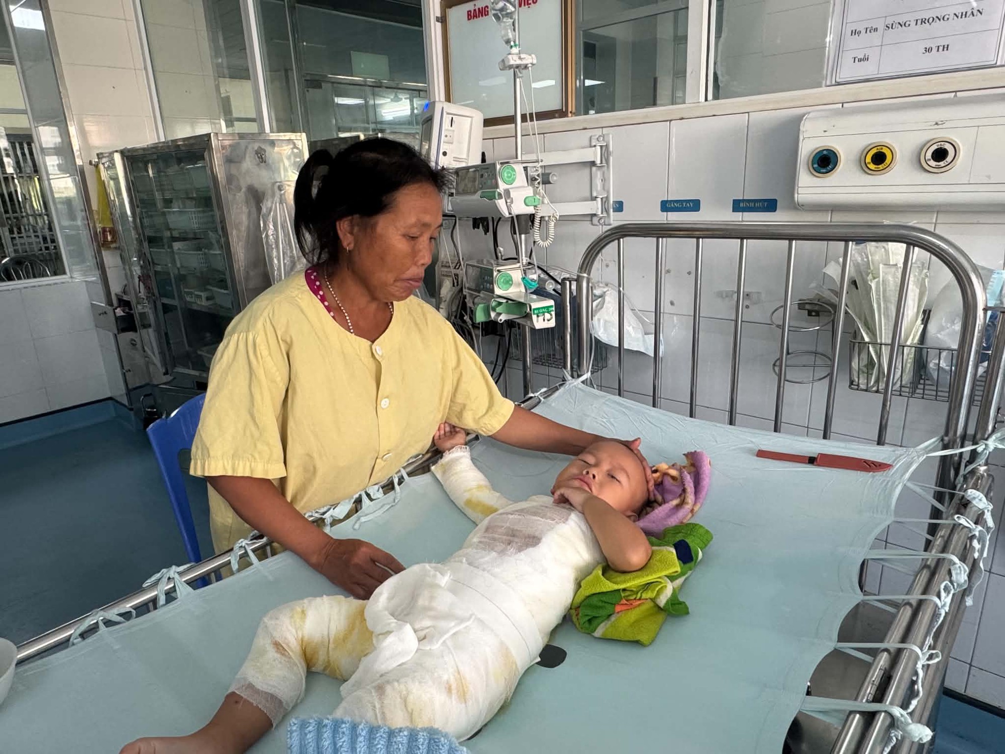 MS 1108: Bé trai dân tộc H’Mông 3 tuổi bị bỏng nặng cần sự giúp đỡ - Ảnh 3.