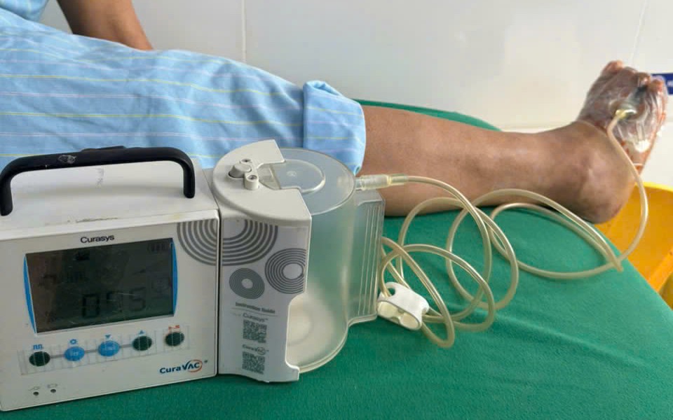 Phẫu thuật cứu bước đi cho chàng trai trẻ 20 năm khập khiễng- Ảnh 3.