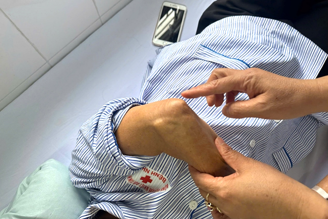 Nguyên nhân bất ngờ khiến người phụ nữ bị đau buốt khuỷu tay nhiều ngày - Ảnh 2.