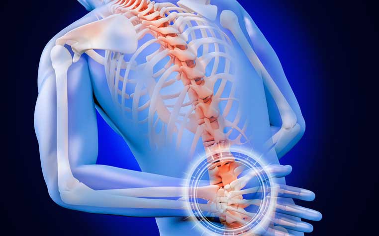 Ai cần thận trọng hoặc không nên tự ý kéo giãn cột sống cổ? - Ảnh 3.