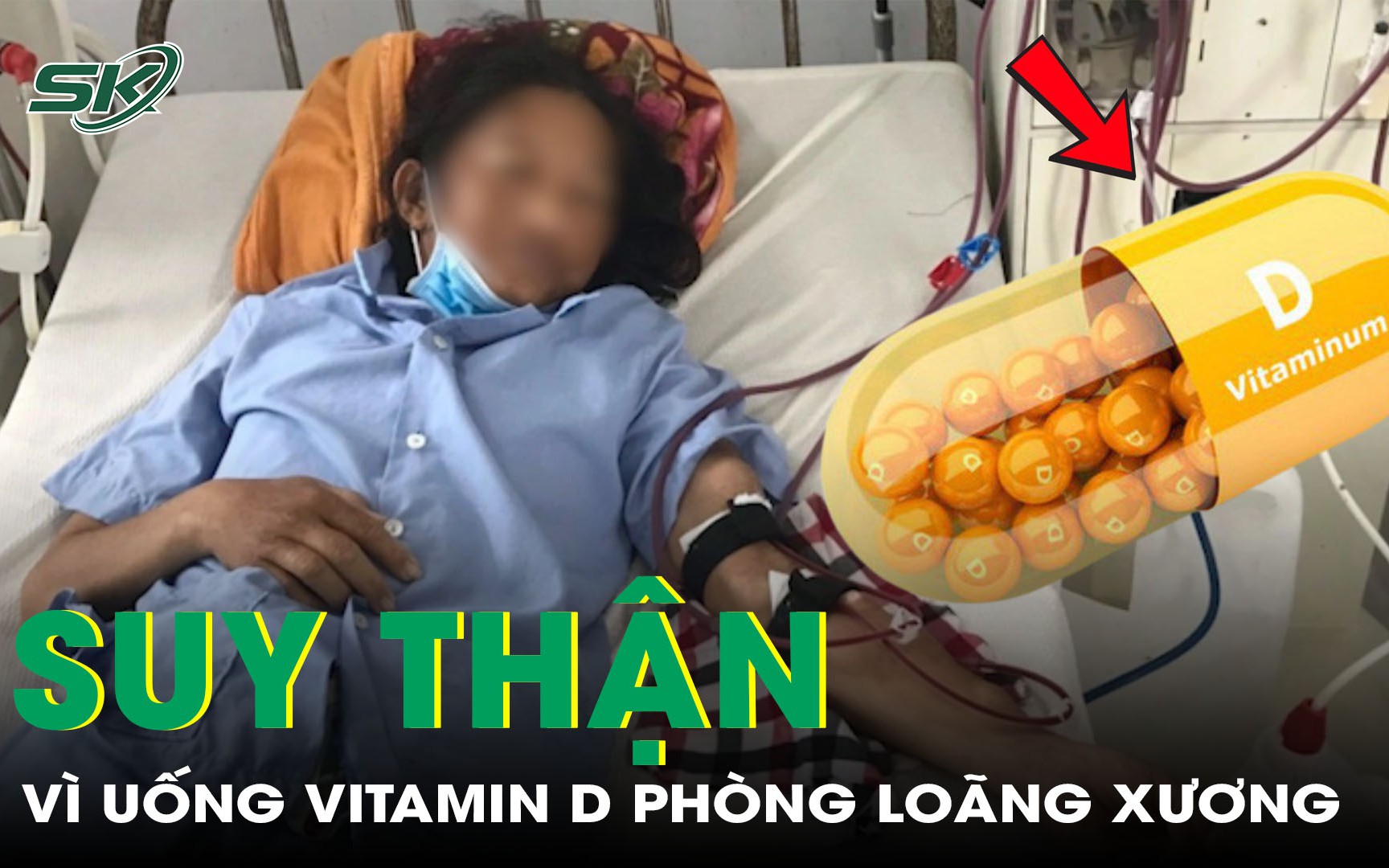 Bí quyết làm chậm nguy cơ loãng xương ở tuổi 40- Ảnh 2.
