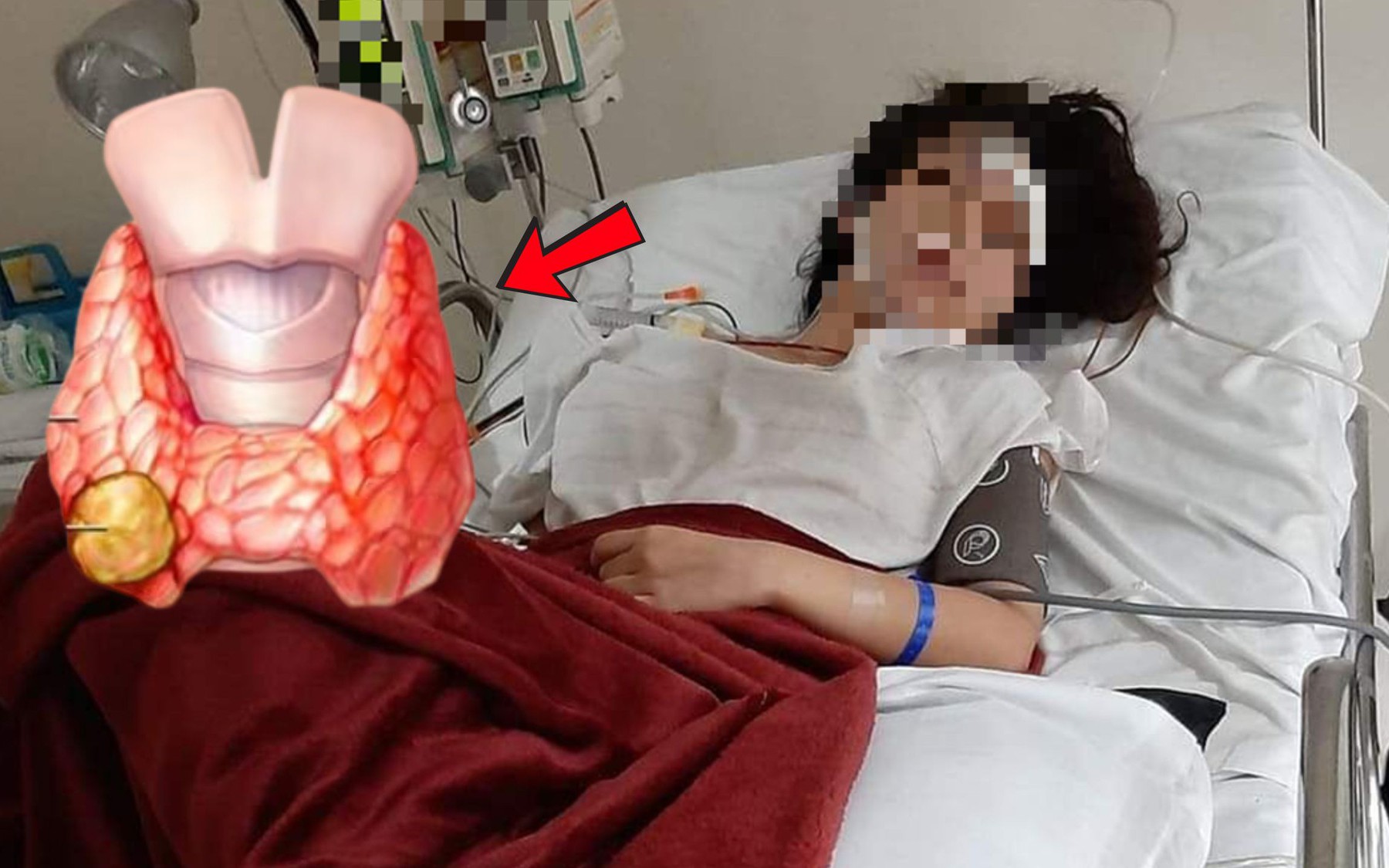 Các phương pháp điều trị ung thư tuyến giáp - Ảnh 2.
