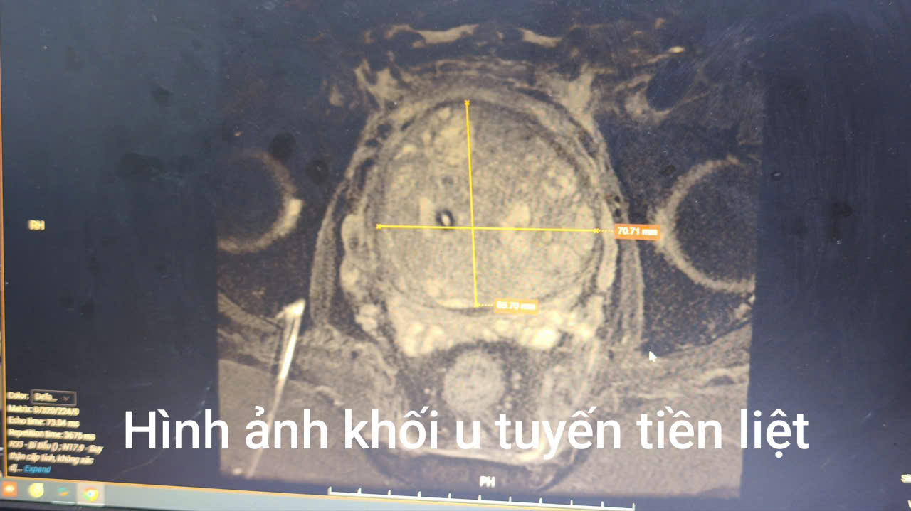 - Ảnh 2.