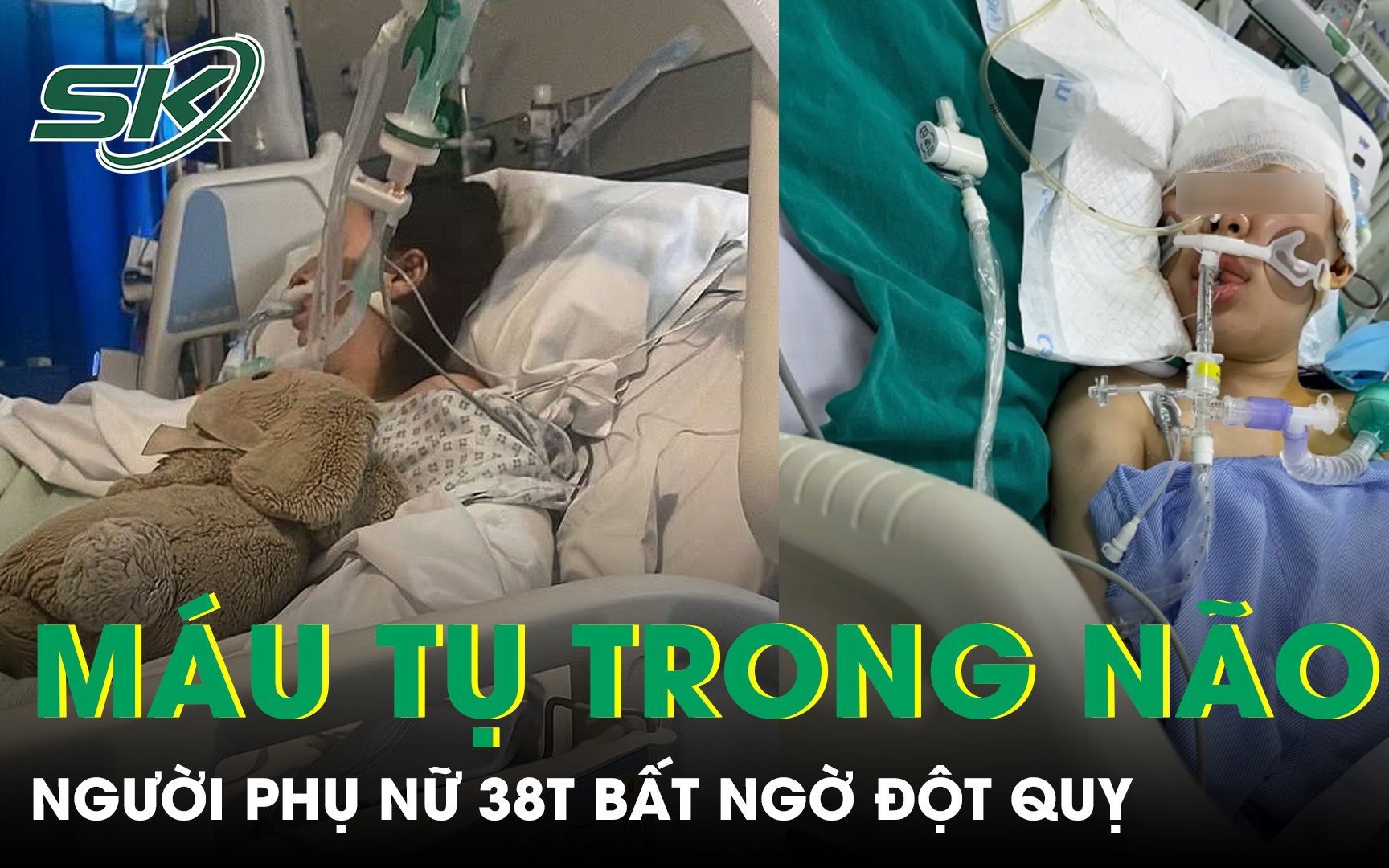 Khi ép tim và hồi sức liên tục cứu sống người ngừng tim: bài học từ một ca cấp cứu tại TP.HCM