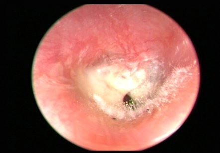 Dính bệnh vì 'thú vui' từ tiệm hớt tóc 2