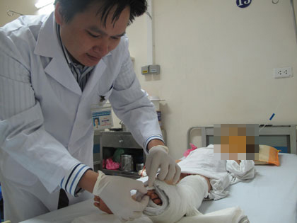 Bé gái gần đứt lìa bàn chân vì miếng chắn pô xe máy 2