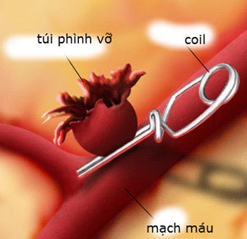 10 Thành tựu khoa học công nghệ y dược nổi bật năm 2012  2