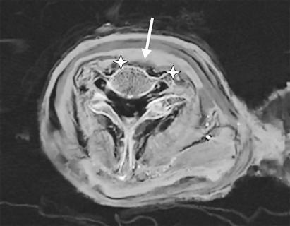Giải mã cái chết bí ẩn của Vua Ramesses III 2