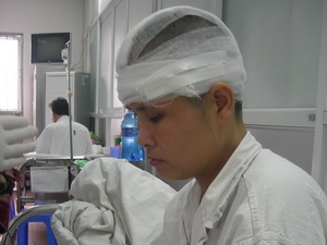 Cứu sống 1 người bị máy cuốn lột hẳn nửa da dầu 1