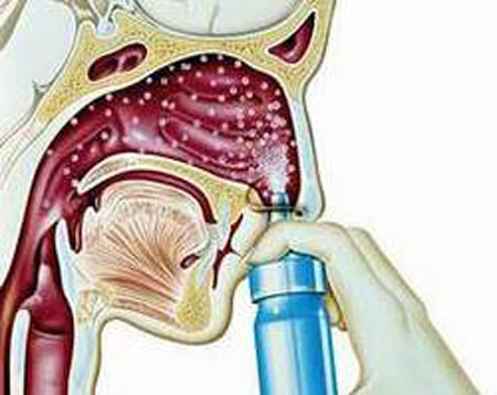 Corticoid dạng xịt cho phụ nữ mang thai? 1 Corticoid dạng xịt cho phụ nữ mang thai? 1