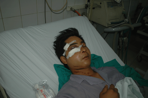 Công an kết luận vụ tổ công tác 141 bị tố đánh dân 1