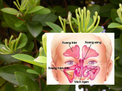 Bài thuốc trị viêm xoang 1