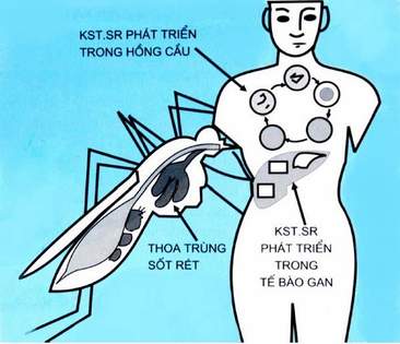 Xử trí trường hợp điều trị sốt rét thất bại 2 Xử trí trường hợp điều trị sốt rét thất bại 2