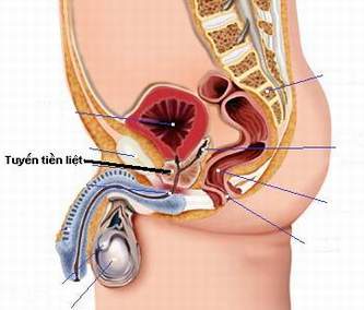 Bài thuốc trị phì đại lành tính tuyến tiền liệt 2
