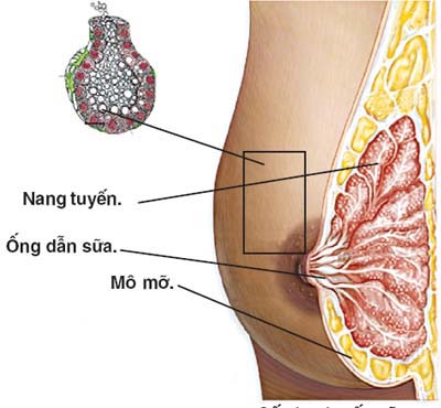 Ðau nhũ hoa, nỗi phiền muộn của phụ nữ 1 Ðau nhũ hoa, nỗi phiền muộn của phụ nữ 1