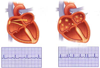 Các khuyến cáo đặc biệt 1