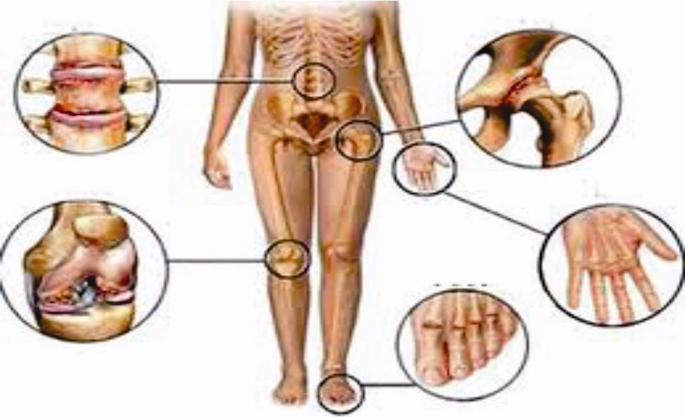 Thuốc đặc hiệu dùng trong các bệnh khớp 1 Thuốc đặc hiệu dùng trong các bệnh khớp 1