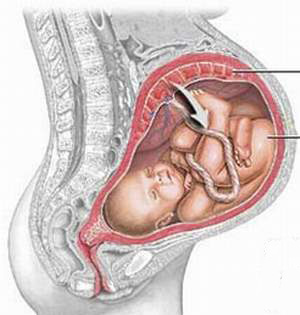 Lây truyền HIV từ mẹ sang con sẽ được loại trừ năm 2015 2 Lây truyền HIV từ mẹ sang con sẽ được loại trừ năm 2015 2