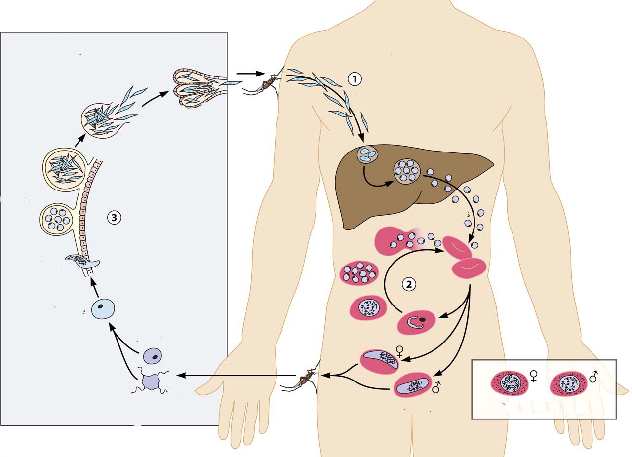 Sốt rét sơ nhiễm dễ chuyển thành sốt rét ác tính gây tử vong 1