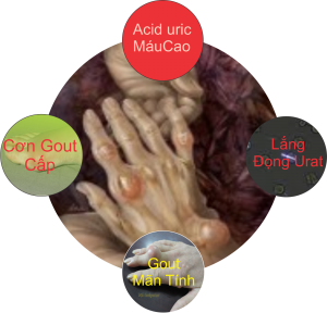 Ăn uống để phòng bệnh gút 2