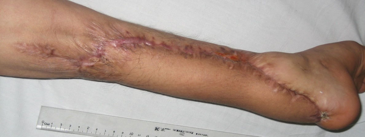 Chuyện thần thoại của y học Việt Nam 2