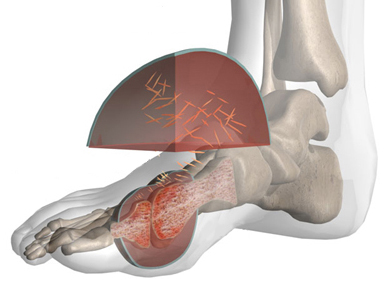 Ăn uống để phòng bệnh gút 3