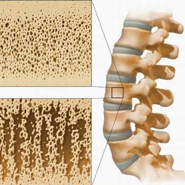 Thông tin mới về phản ứng có hại của thuốc 3