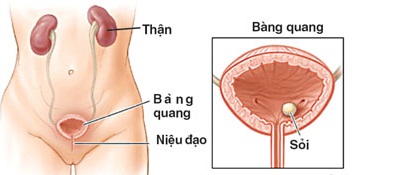 Bệnh hay gặp khi mang thai 1 Bệnh hay gặp khi mang thai 1