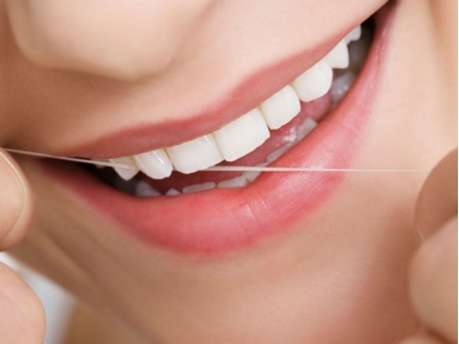 Chỉ tơ nha khoa có tác dụng gì? 1