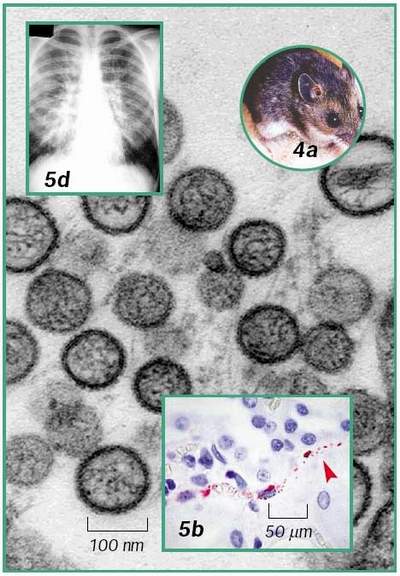 Phòng lây nhiễm Hantavirus từ chuột  1