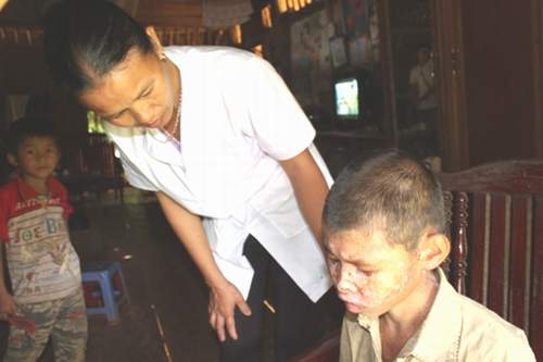 Xóa ám ảnh “ma ngứa” 1